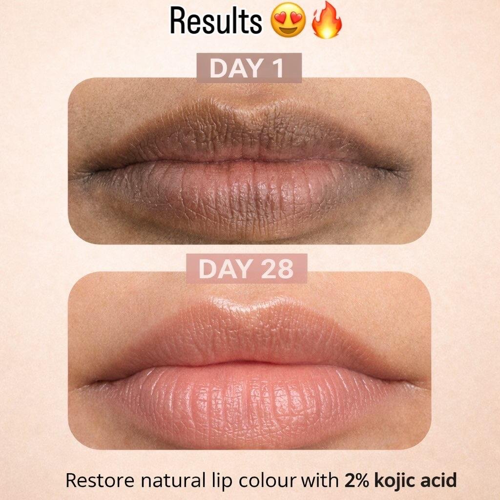 Lipfix - Image 3