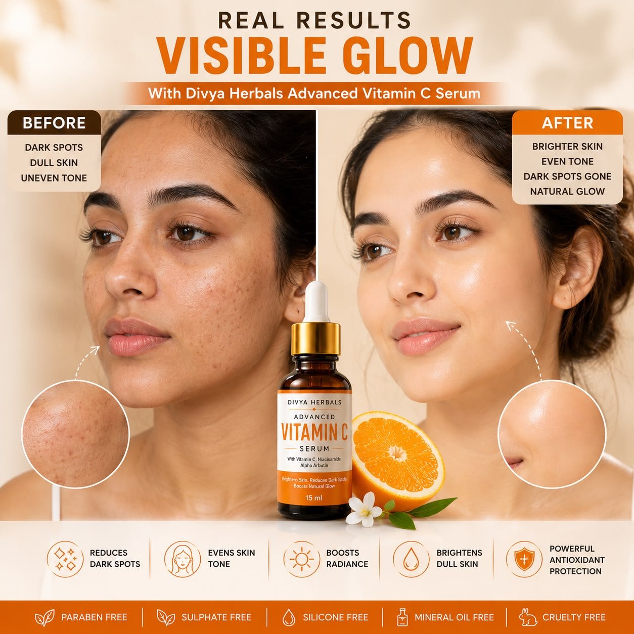 Advanced Vitamin C Face Serum for Glowing Skin, Dark Spots & Pigmentation | With 3-O-Ethyl Vitamin C, Niacinamide & Alpha Arbutin | 15ml thumbnail 4